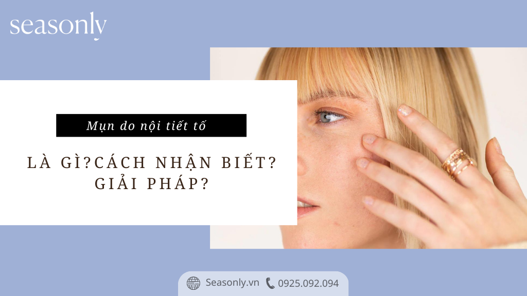 MỤN DO NỘI TIẾT TỐ LÀ GÌ? CÁCH NHẬN BIẾT? GIẢI PHÁP?