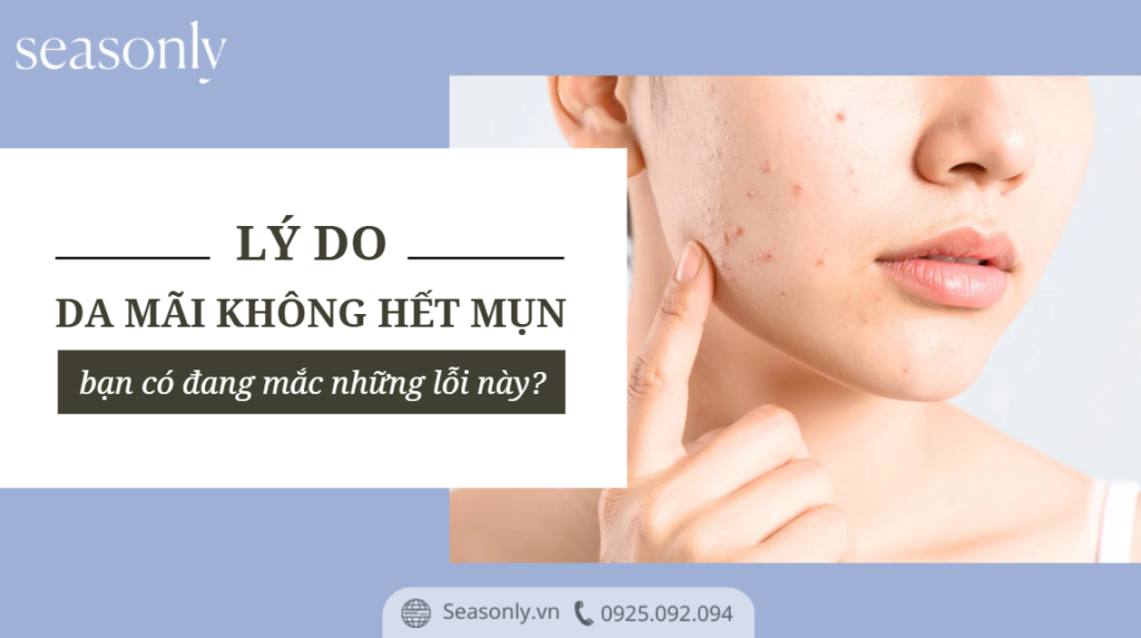 Những lý do khiến da mãi không hết mụn, bạn có đang mắc phải những lỗi này? 1